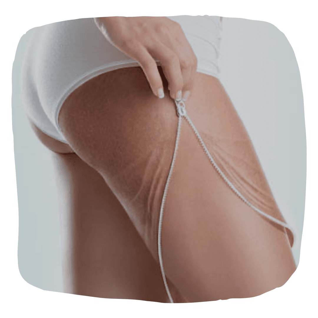 SUPERSlim BODY